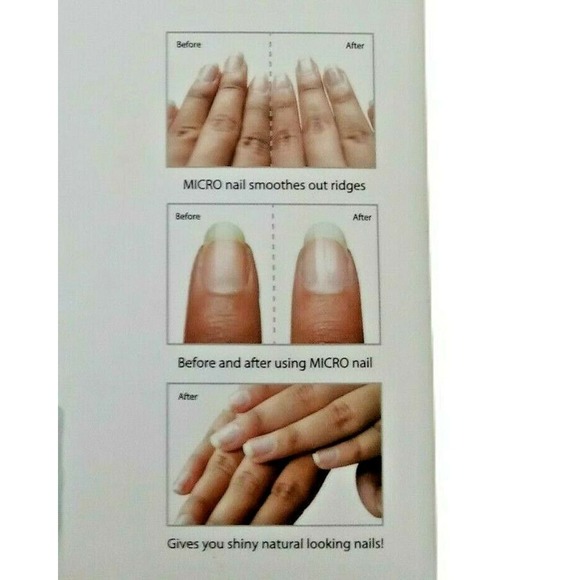 Emjoi Micro Nail Polisher Buffs Smooths Shines Get Healthy Nails Home Care Kit - Picture 10 of 12